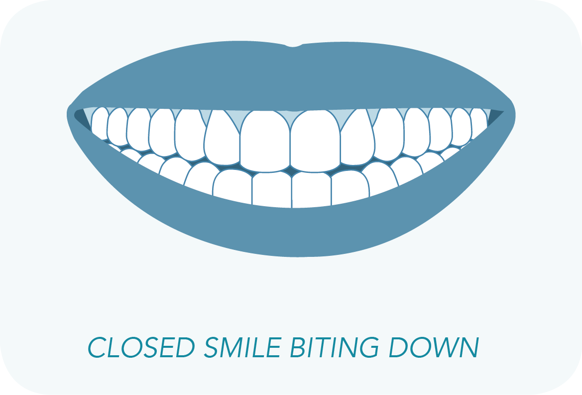 Want To Have An Impressions Doctor See If You're A (1169x795), Png Download