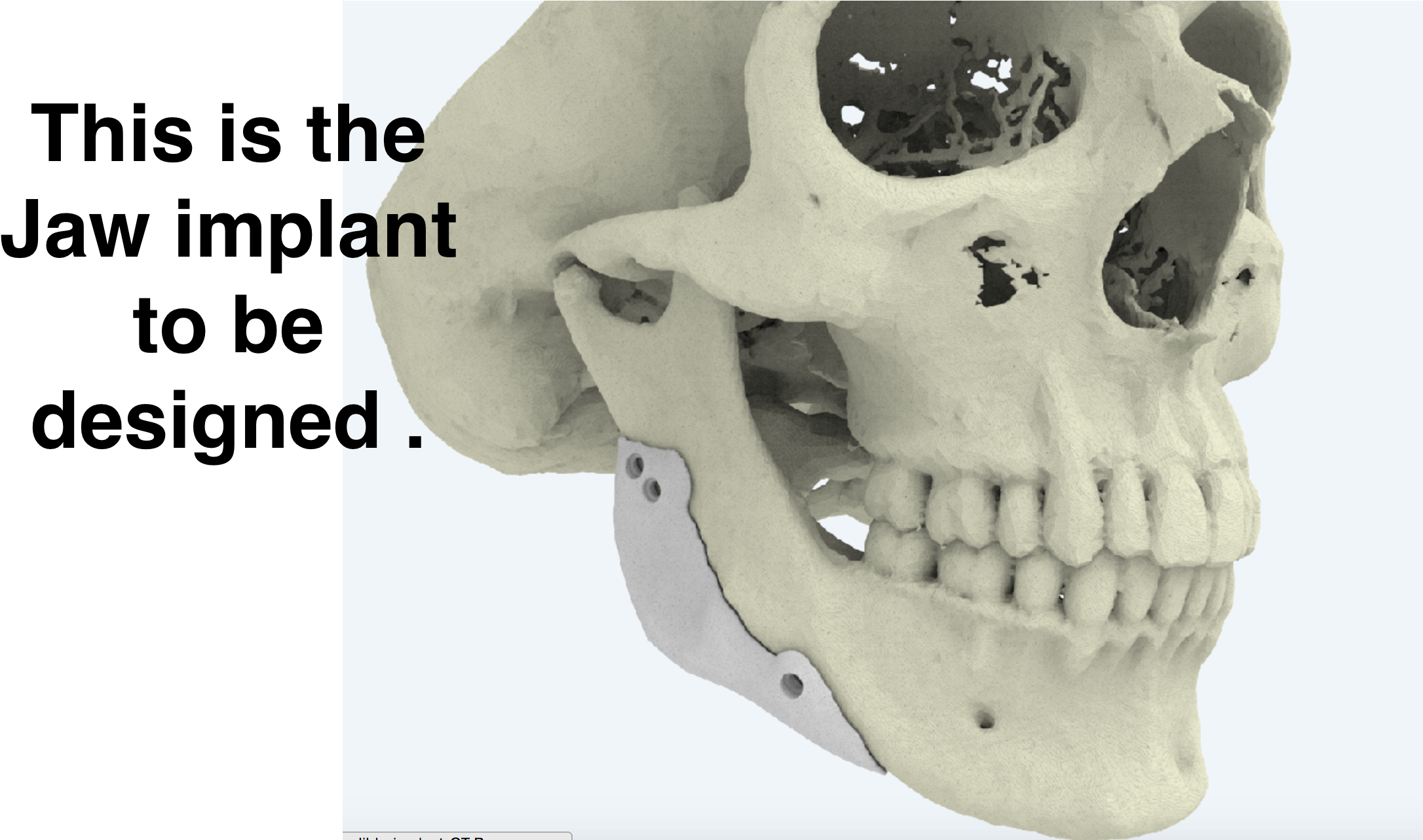 Jaw Implant Idea - Danger This Is Sparta (2560x1600), Png Download