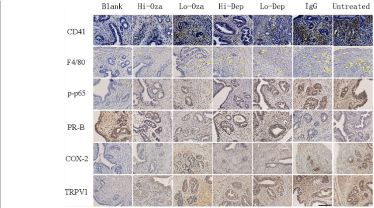Representative Photomicrographs Of Indicated Immunostaining (850x408), Png Download