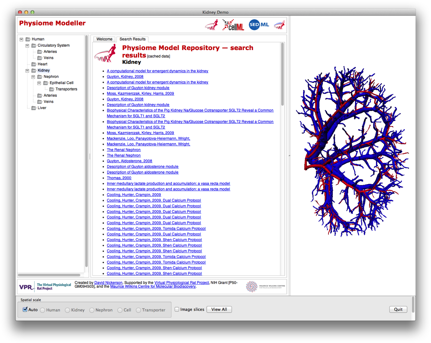 Images/renal-vasculature - News (1412x1125), Png Download