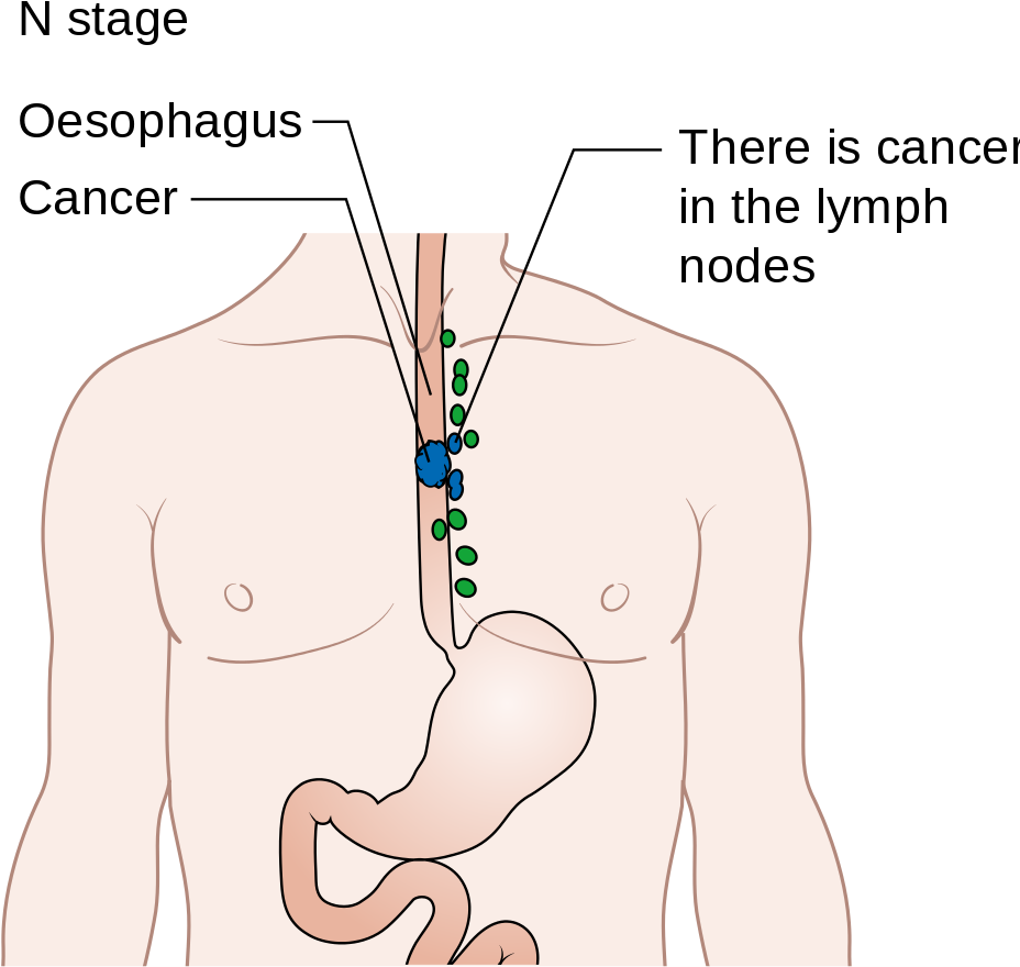 Diagram (995x1024), Png Download
