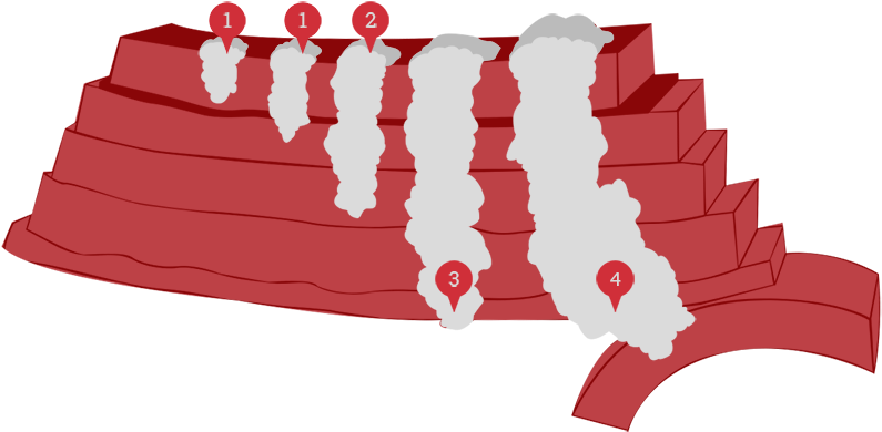 Stage Ii Cancer Has Grown - Illustration (794x400), Png Download