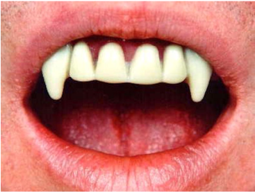 Vampire Teeth For Kids Download - Ghost Teeth (366x580), Png Download