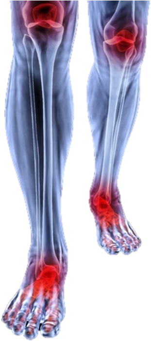 Foot Pain And Knee Pain - Joint Pain Transparent Background (703x703), Png Download