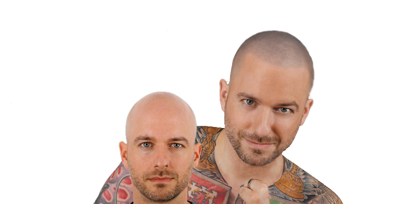 Bald - Hair Loss (1500x400), Png Download