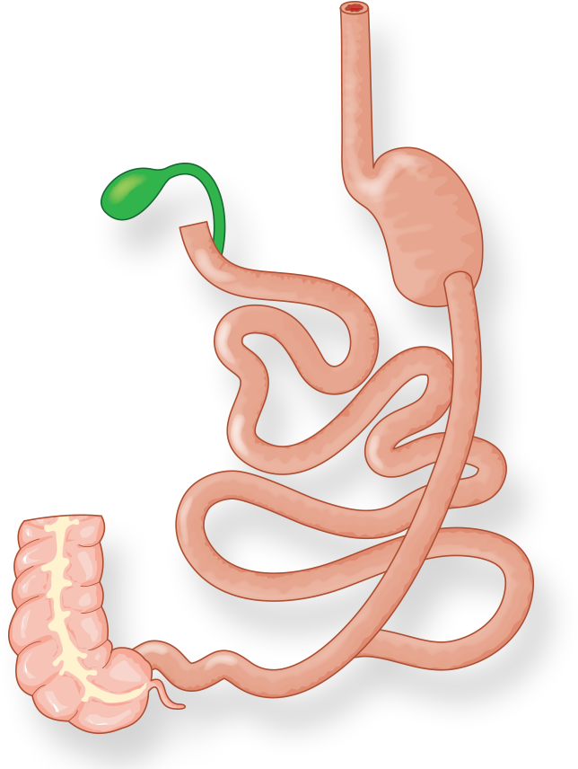Illustration Of Intestines And Stomach After Duodenal - Duodenal Switch (808x972), Png Download