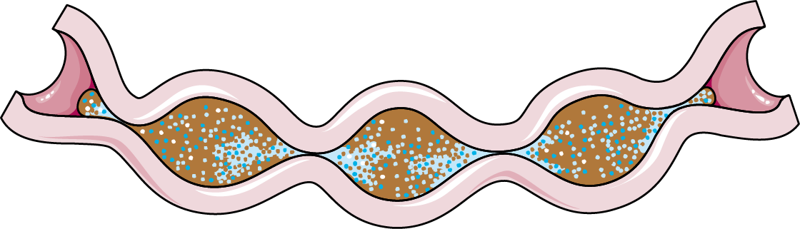 Intestine Segmentation (1120x321), Png Download