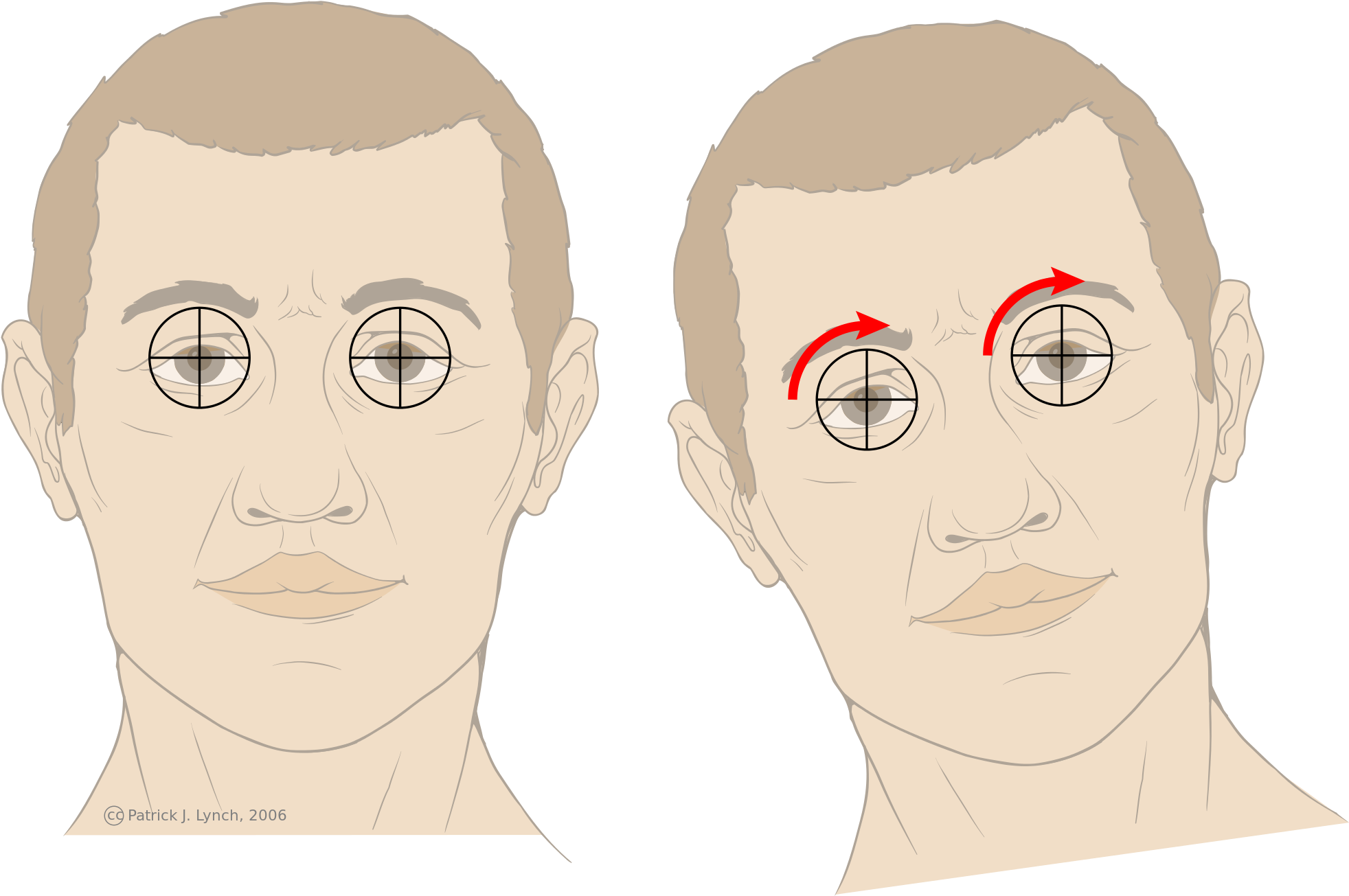 Open - Vestíbulo Ocular (2000x1333), Png Download