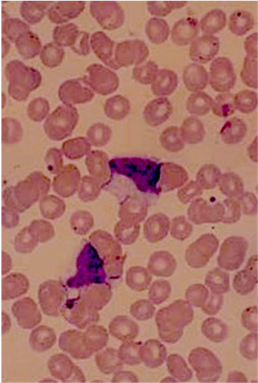 Peripheral Blood Smear (903x541), Png Download