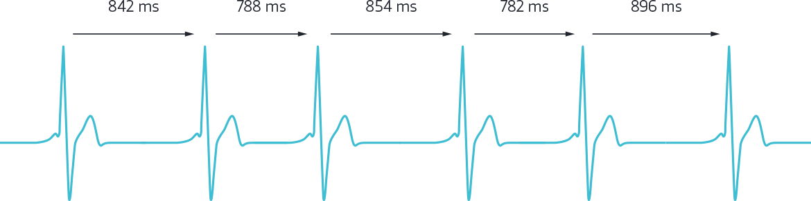Diagram (1170x291), Png Download