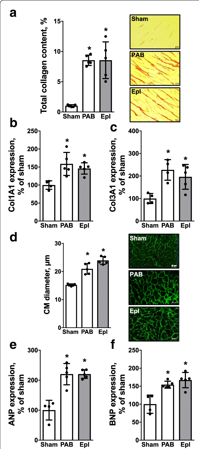 Eplerenone Has No Direct Effect On Pressure Overload-induced (689x1555), Png Download