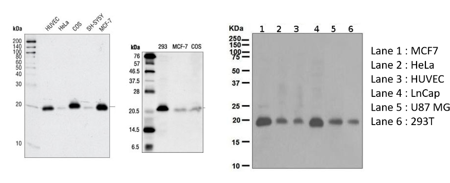 Cdkn1a Antibodies Cst Abcam Right (1000x356), Png Download