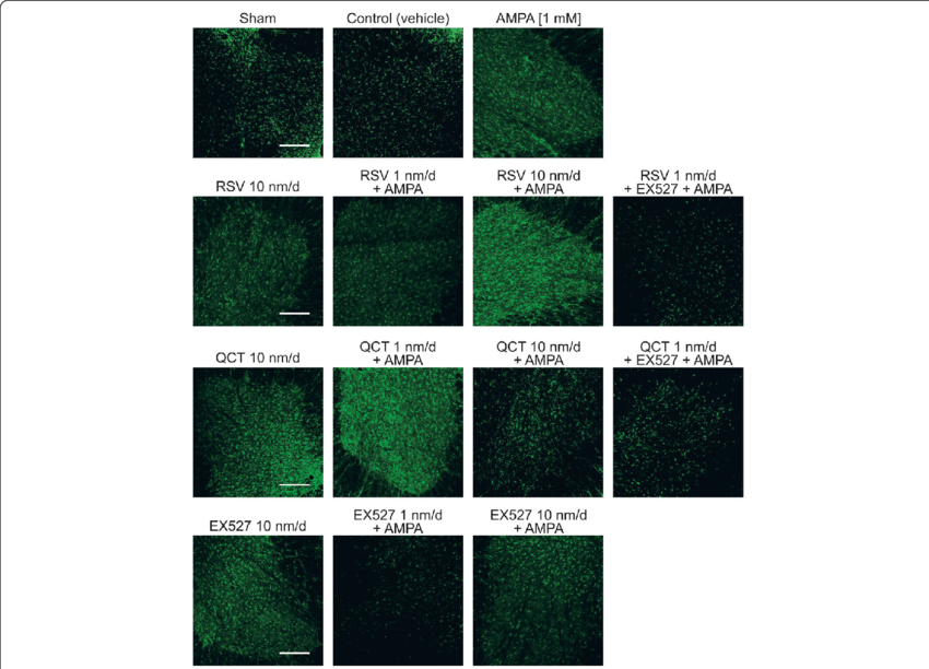 Effect Of Rsv, Qct And Ex527 On Spinal Astroglial Cell (850x612), Png Download