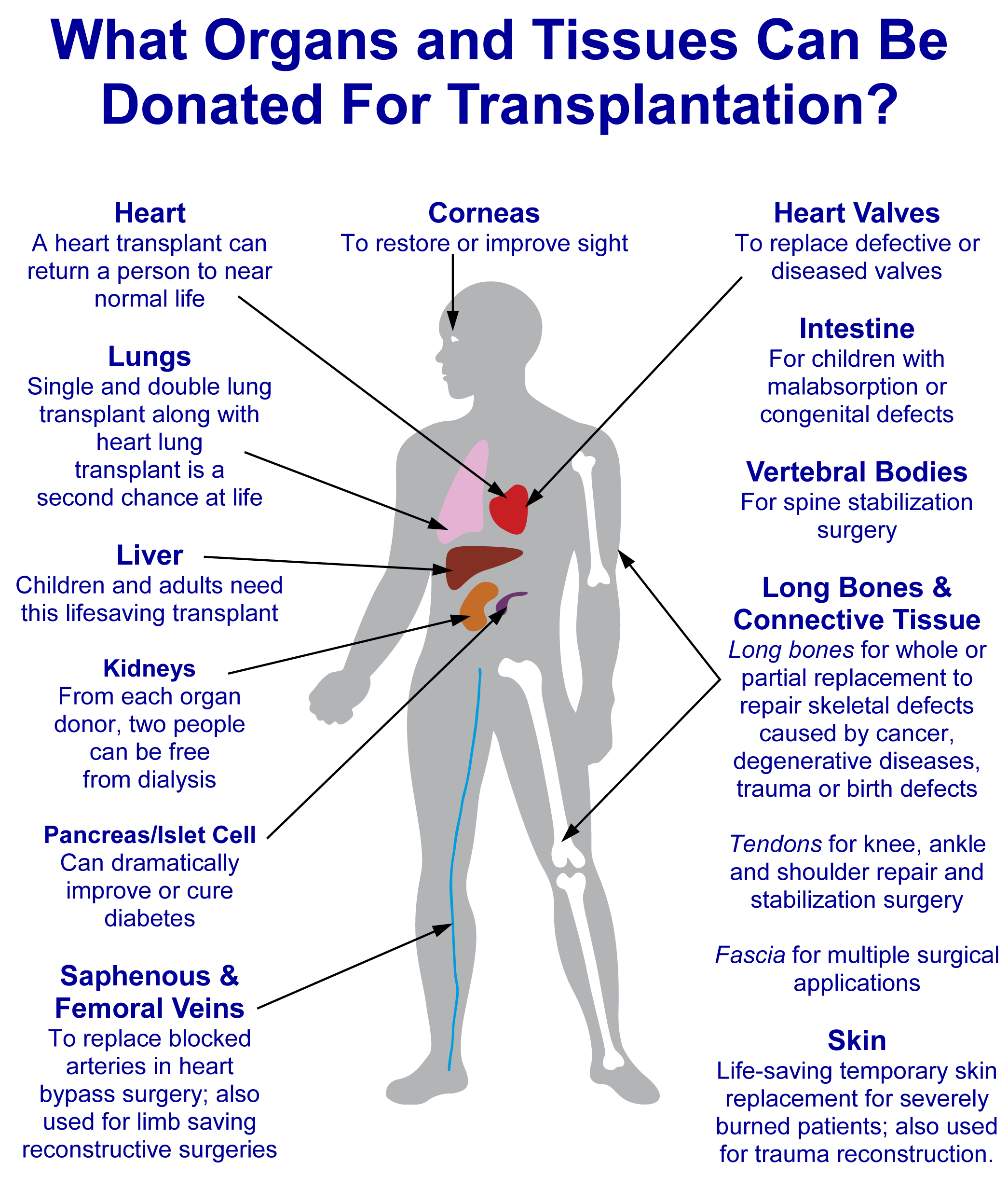 Donation Diagram (2106x2506), Png Download