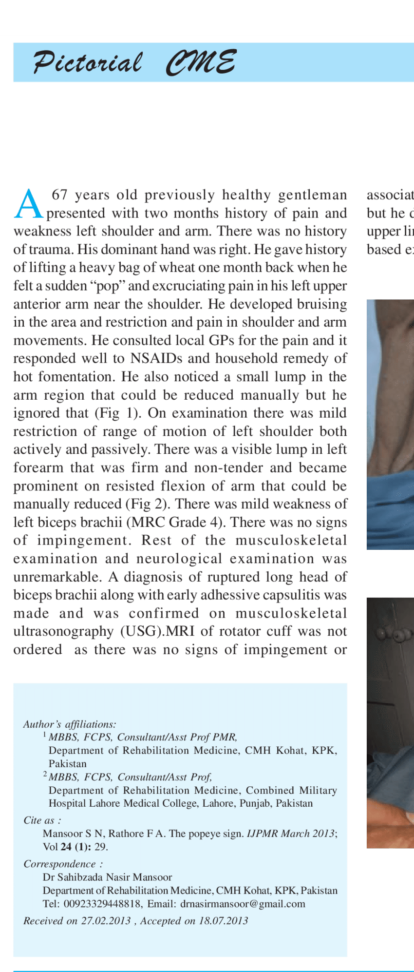 Left Arm With A Prominent Bulge (850x1994), Png Download