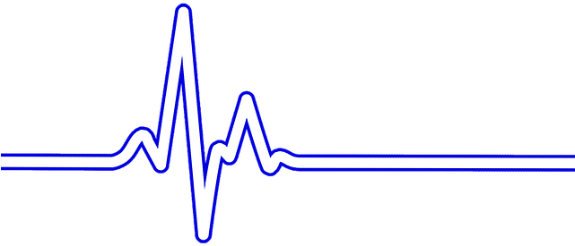 Heart Rate, Bpm, Ecg, Ekg, Electrocardiogram, Ecg Waves - Gambar Detak Jantung Png (640x480), Png Download