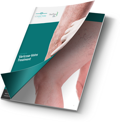 Download Your Free Guide To Varicose Veins - Varicose Veins (400x397), Png Download