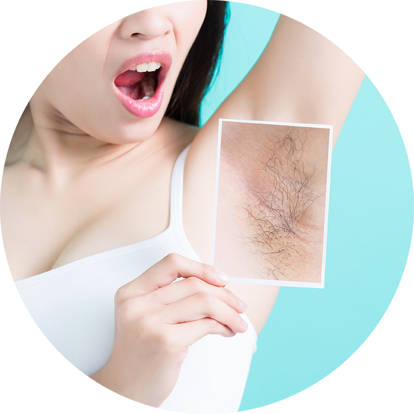 Laser Hair Removal Treatment (813x813), Png Download