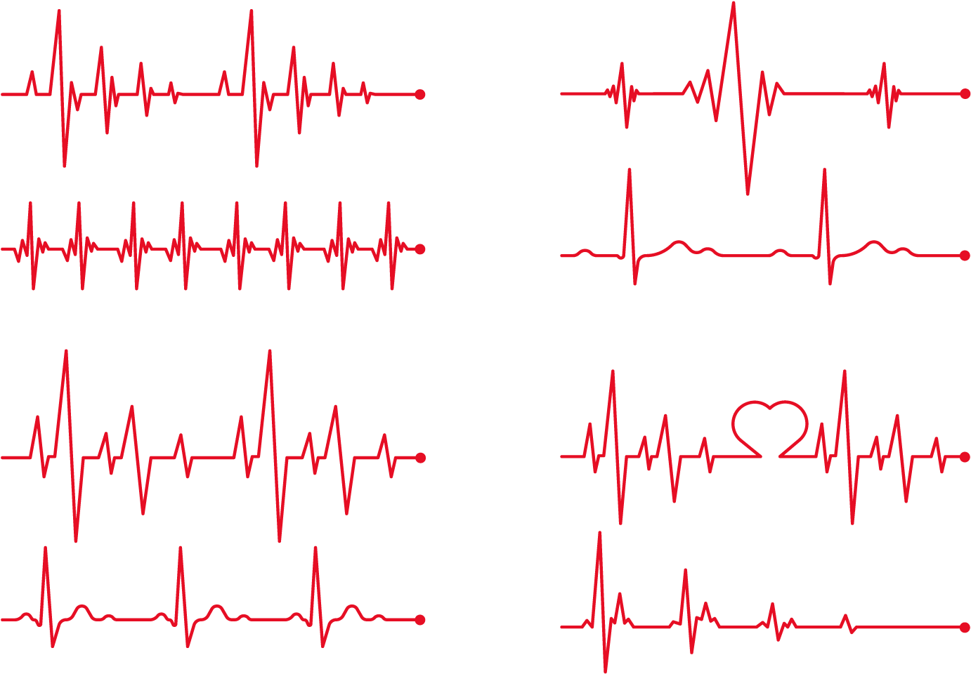 Heart Rate Electrocardiography Clip Art - Batimentos Cardiacos Vetor Png (1458x1020), Png Download