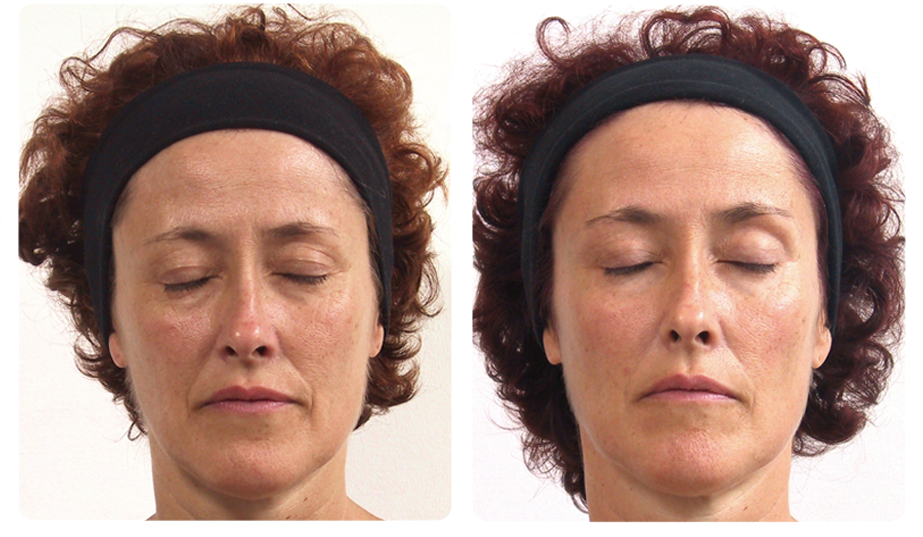 Complete Anti Ageing (922x552), Png Download