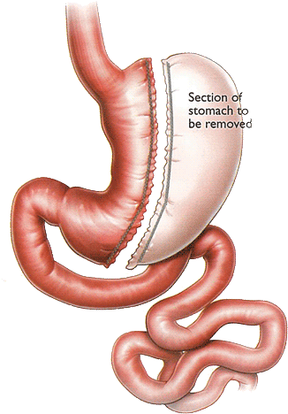 Our Services - Earthworm (500x551), Png Download