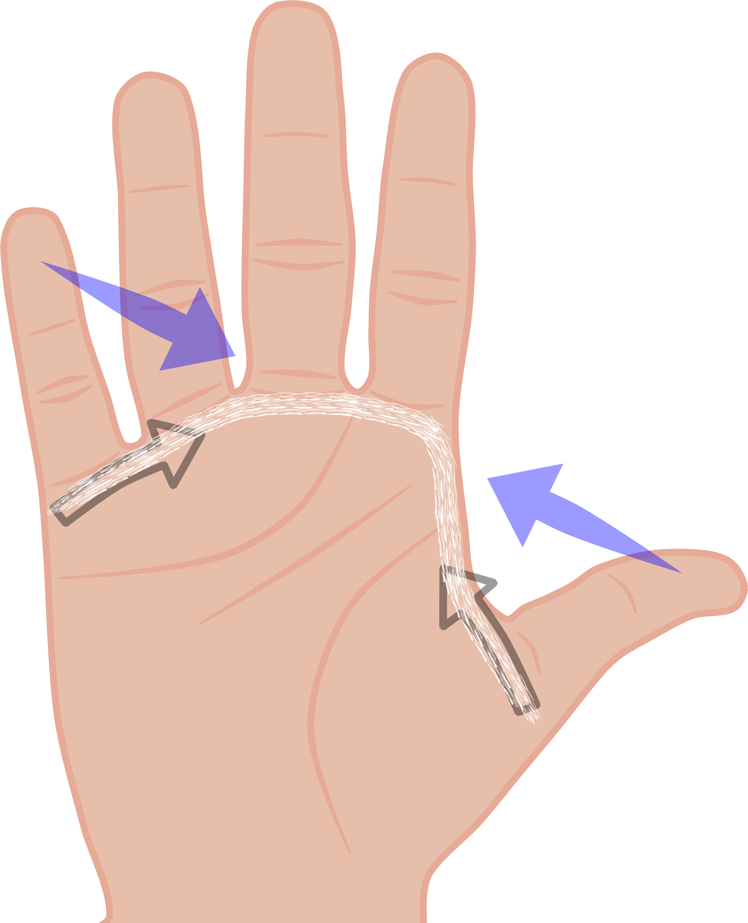Is That Dupuytren Often Affects A Line Of Tissue Which - Glove (2406x2966), Png Download