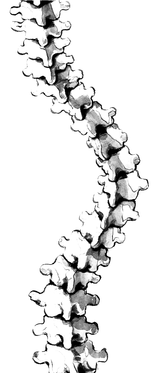 Scoliosis At Getdrawings Com Free For Personal (570x1254), Png Download