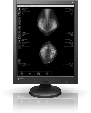 Changing The Mammographic Imaging Paradigm - Eizo Radiforce G5310 (400x410), Png Download