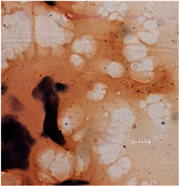 A Small Fragment Of A Mouse Pellet From An Antibiotic (903x375), Png Download