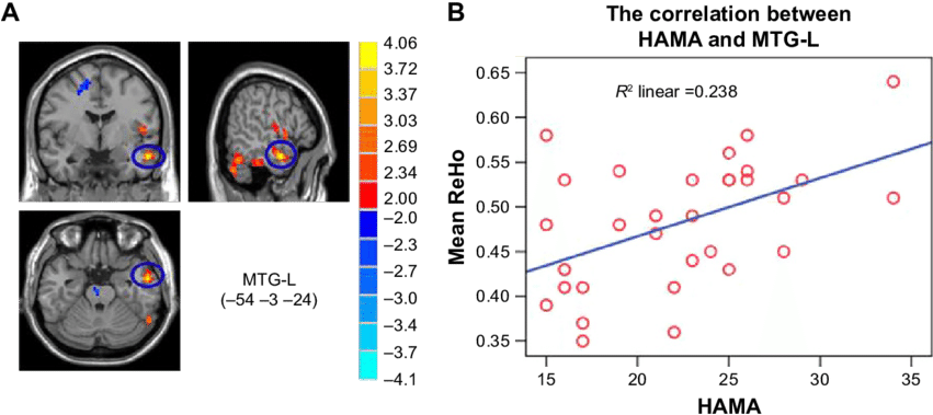 Correlation Between Mtg L And Hama Scores (850x386), Png Download