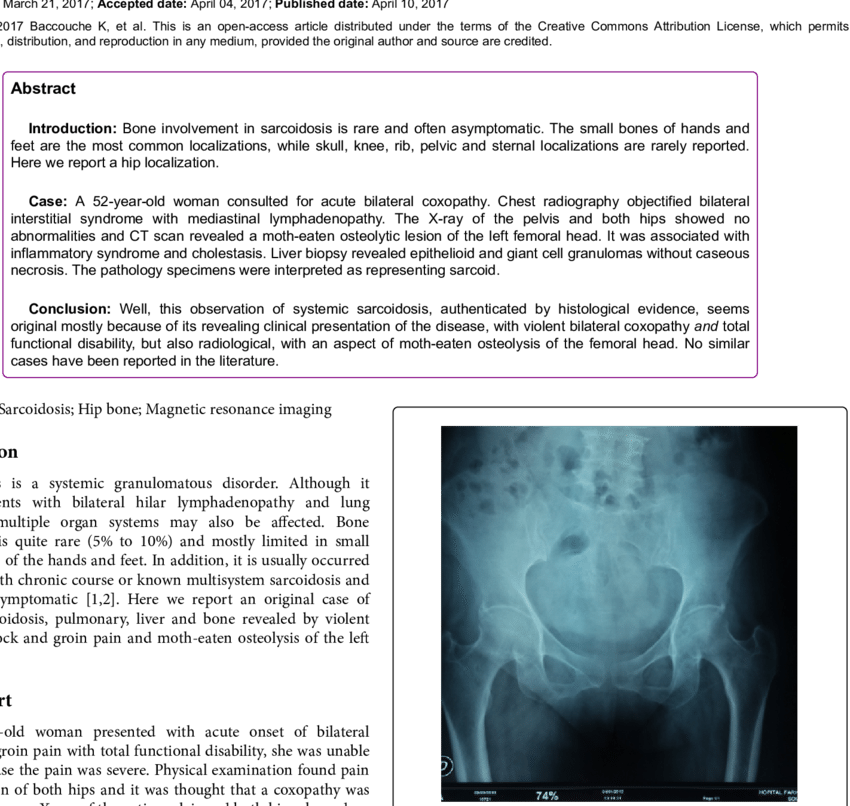 X-ray Of The Entire Pelvis And Both Hips Showed No (850x806), Png Download