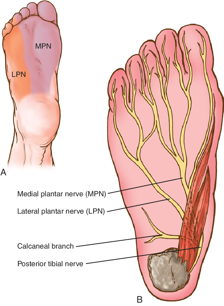 Compression Of Either The Posterior Tibial Nerve At (738x1007), Png Download