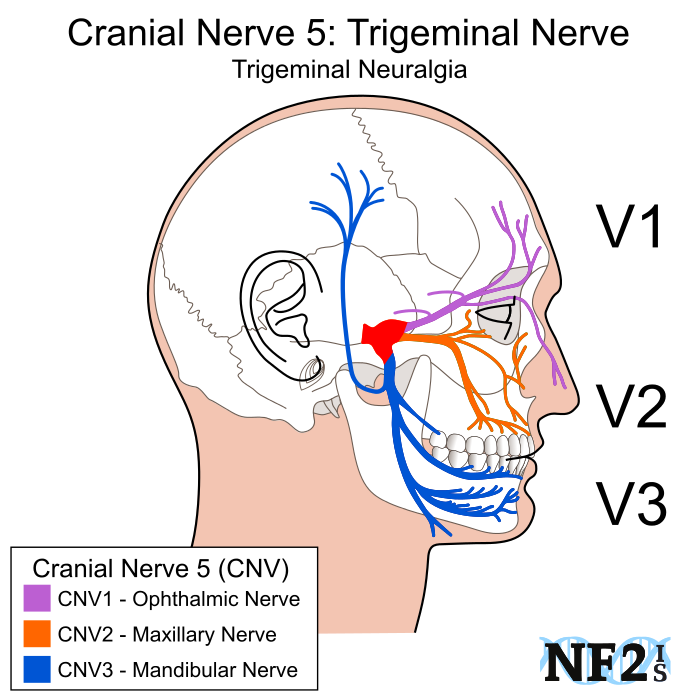 Cranial Nerve 5, Subparts, 3 Branches, Branches, Filiment, (700x700), Png Download