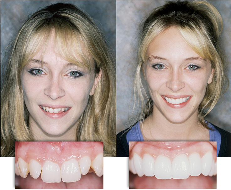Dramatic Before And After Transformation At Integrative (736x675), Png Download