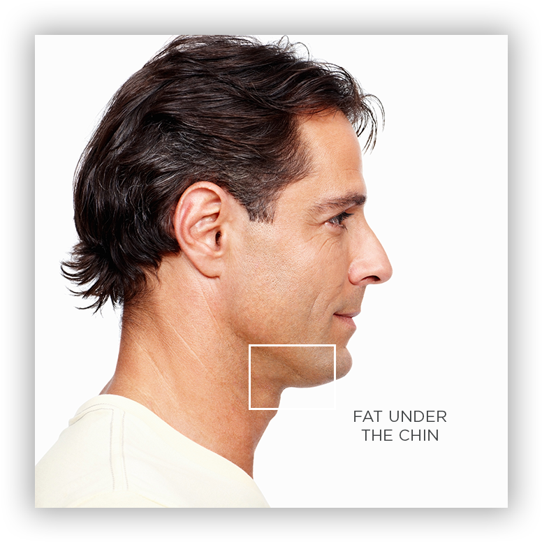 We Can Treat The Following Conditions That Result In (798x782), Png Download