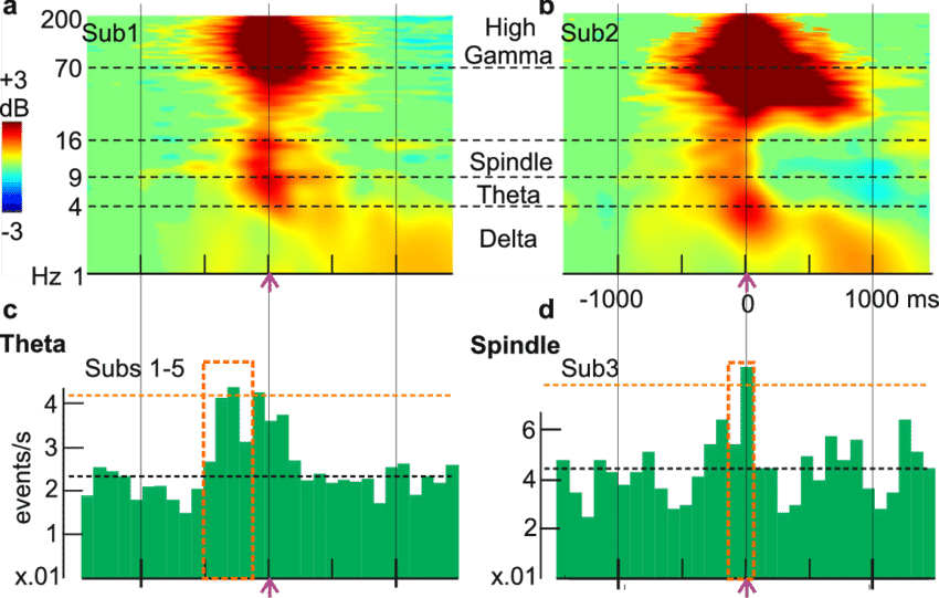 Putative Replay Frames Are Associated With Spindle, (850x541), Png Download