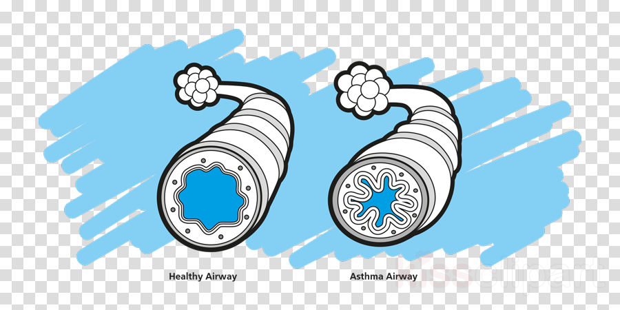 Asthma Png Clipart Asthma Spacer Respiratory Tract (900x450), Png Download