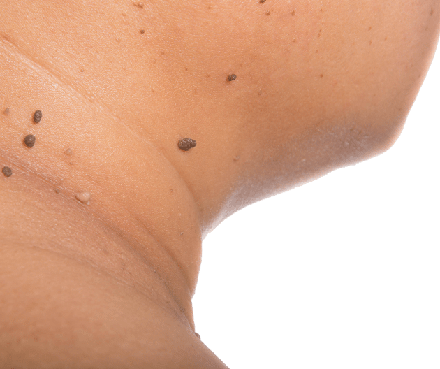 Mole (630x528), Png Download