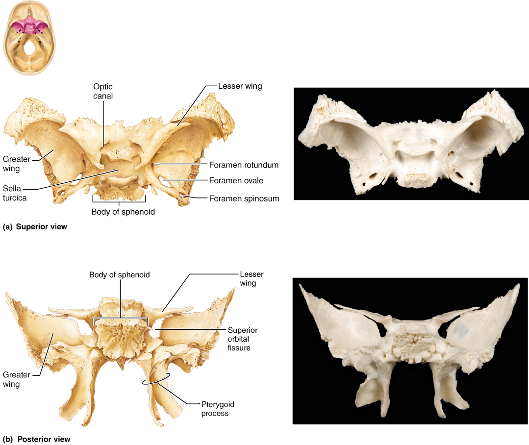 The Skull (1079x908), Png Download