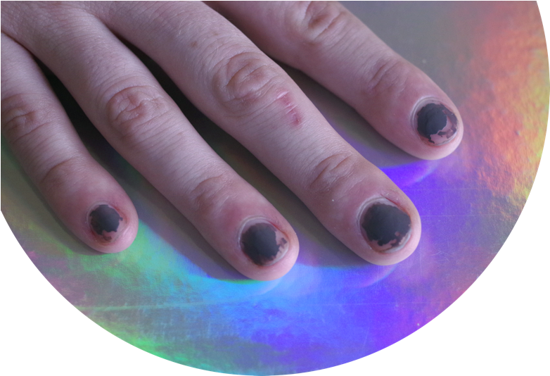 Don't Bite Your Nails - Nail (800x533), Png Download