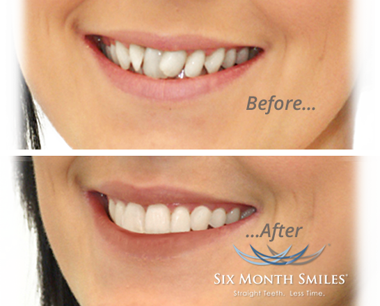 Slide-six Month Smile - Lip Gloss (546x440), Png Download