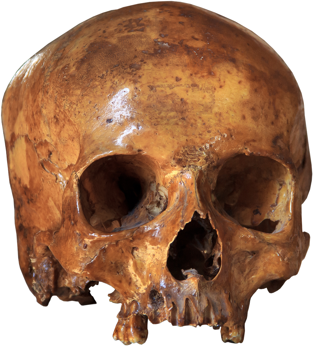 Skull Skeleton Bone - Esqueleto Cranio (1179x1280), Png Download