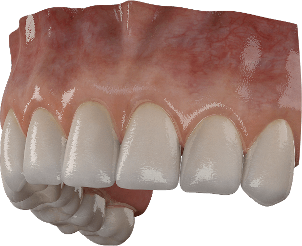 3d Teeth Data Sheet - 3d Teeth (619x505), Png Download