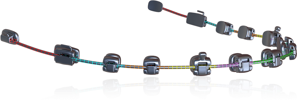 Smartarch Laser Engineered Cuniti - Bead (950x801), Png Download