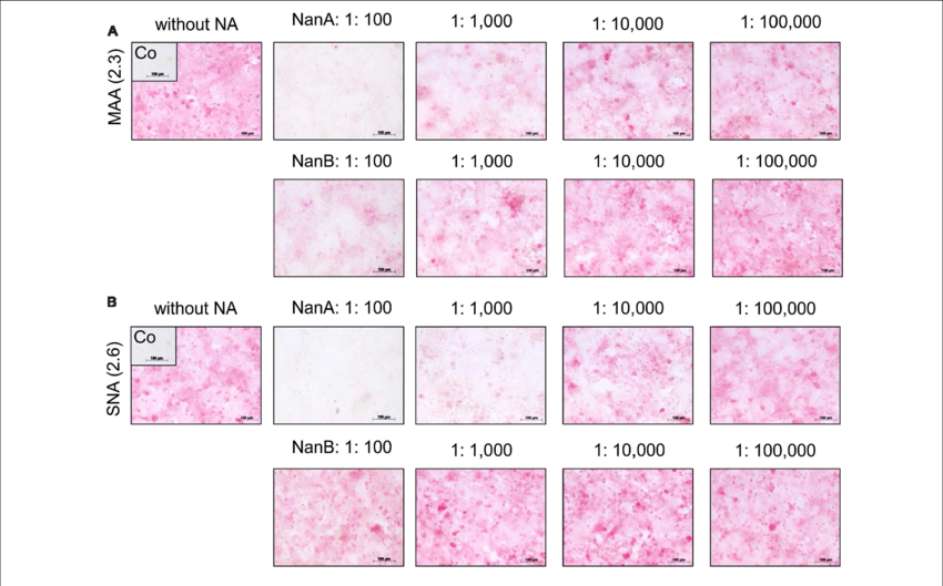 Influence Of Recombinant Nana And Nanb On Expression - Style (850x529), Png Download