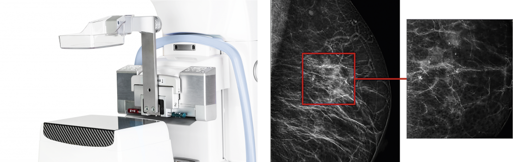 Artemis' Sterotactic Biopsy System Guides You Through - Floor (1024x325), Png Download