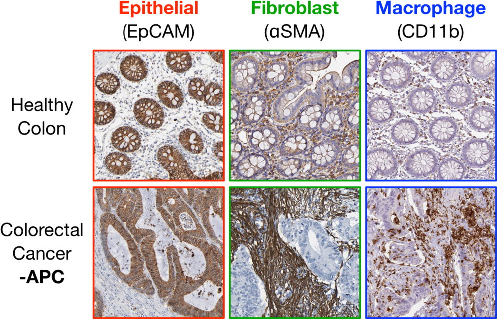 Figure 1 - Igneous Rock (1000x655), Png Download