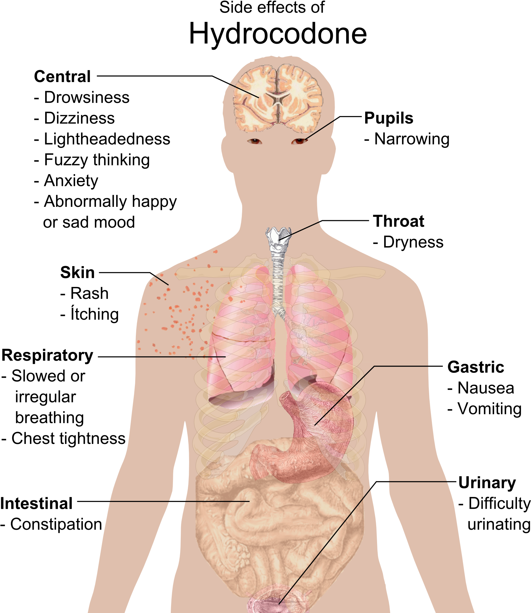 Dictionary Garcinia Cambogia Order Number 5409 48603 - Symptoms Of Ebola (1757x1994), Png Download