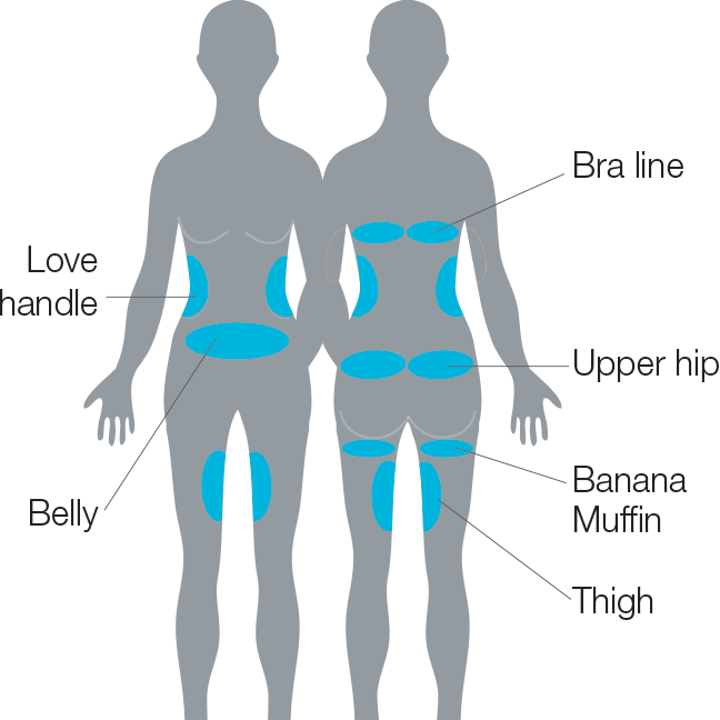 Micool-a Cryo Fat Reduction Tummy Treatments Love Belly - Silhouette (648x648), Png Download