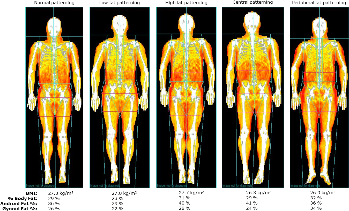 Figure 6 Fat - 3 Kg Of Fat (1382x840), Png Download